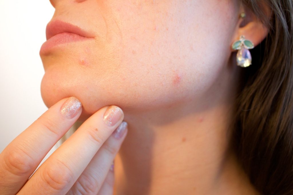 Unlocking Youthful Skin: The Microbiome Connection