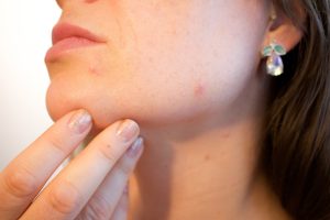 Unlocking Youthful Skin: The Microbiome Connection