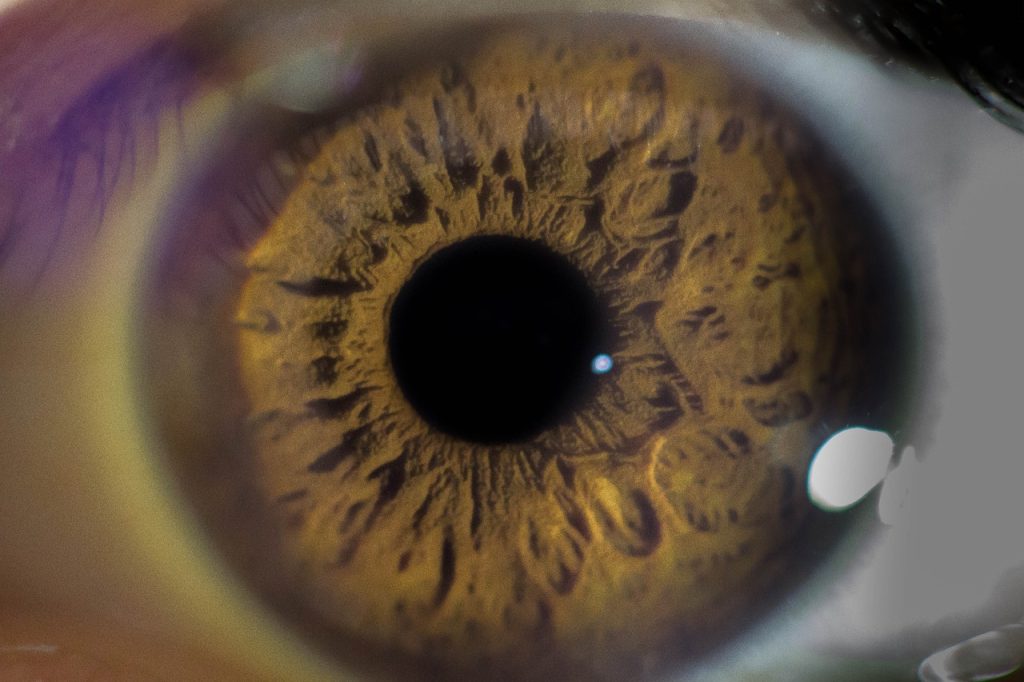 Eye Health