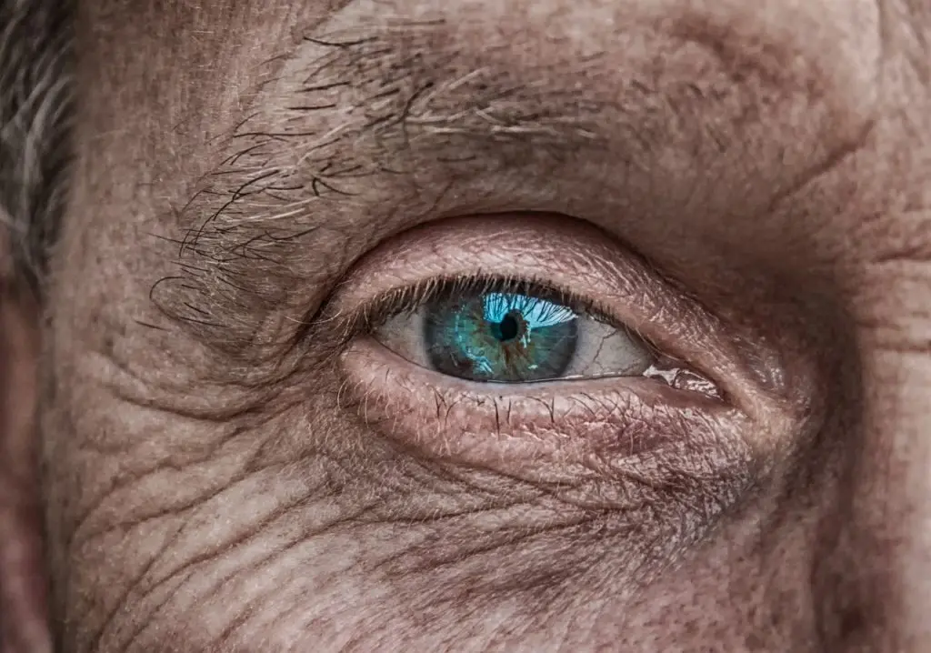 Eyeing Alzheimer's: Retinal Changes Point to Brain Health