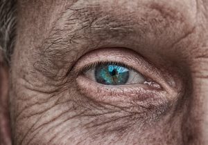 Eyeing Alzheimer's: Retinal Changes Point to Brain Health